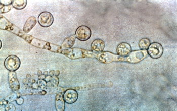 Candida под микроскопом