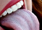 Механическая травма языка