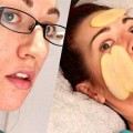 Рецепты из сырого и вареного картофеля для лечения прыщей на лице: маски, отзывы